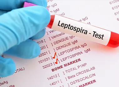 लेप्टोस्पायरोसिस क्या है?