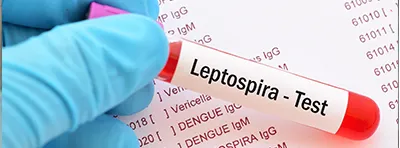 लेप्टोस्पायरोसिस क्या है? 